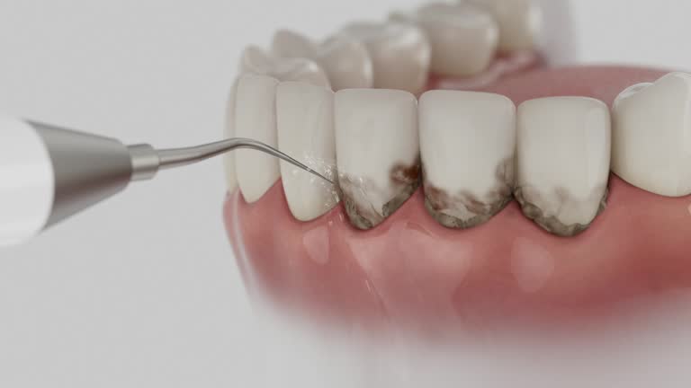 Reliable Dental contractor in Gardner, IL by Smile Center Dentistry